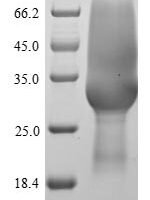 Rat Sclerostin domain-containing protein 1 (Sostdc1) Recombinant Protein, N-His-SUMOstar - BioCrest Sci
