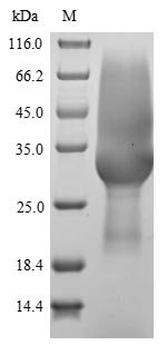 Rat Sclerostin domain-containing protein 1 (Sostdc1) Recombinant Protein, N-His-SUMOstar, Rattus norvegicus (Rat), Yeast, N-terminal 6xHis-sumostar-tagged, 36.6 kDa, purity >≥ 85% as determined by SDS-PAGE.