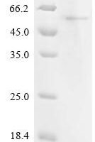 Human YTH domain-containing family protein 2 (YTHDF2), partial Recombinant Protein, C-His, aa 2–389 - BioCrest Sci