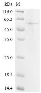 Human YTH domain-containing family protein 2 (YTHDF2), partial Recombinant Protein, C-His, aa 2–389, Homo sapiens (Human), E.coli, C-terminal 6xHis-tagged, 46.9 kDa, purity >≥ 85% as determined by SDS-PAGE.