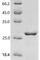 Mouse Uroplakin-3b (Upk3b), partial Recombinant Protein - BioCrest Sci