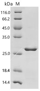 Mouse Uroplakin-3b (Upk3b), partial Recombinant Protein, Mus musculus (Mouse), E.coli, N-terminal 6xHis-tagged, 24.6 kDa, purity >≥ 90% as determined by SDS-PAGE.