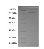 Human Docking protein 1 (DOK1) Recombinant Protein - BioCrest Sci