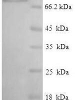 Human Interferon-induced protein with tetratricopeptide repeats 3 (IFIT3) Recombinant Protein - BioCrest Sci