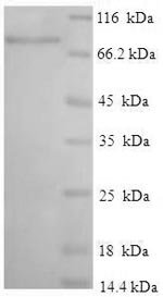 Human Interferon-induced protein with tetratricopeptide repeats 3 (IFIT3) Recombinant Protein, Homo sapiens (Human), E.coli, N-terminal 6xHis-SUMO-tagged, 72.0 kDa, purity >≥ 90% as determined by SDS-PAGE.