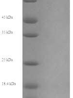 Human Myosin-6 (MYH6), partial Recombinant Protein, N-His, aa 160–816, Yeast - BioCrest Sci