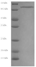 Human Myosin-6 (MYH6), partial Recombinant Protein, N-His, aa 160–816, Yeast, Homo sapiens (Human), Yeast, N-terminal 6xHis-tagged, 76.8 kDa, purity >≥ 90% as determined by SDS-PAGE.