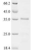 Human SUN domain-containing protein 1 (SUN1), partial Recombinant Protein - BioCrest Sci