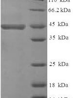Human Receptor-type tyrosine-protein phosphatase zeta (PTPRZ1), partial Recombinant Protein - BioCrest Sci