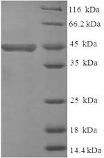 Human Receptor-type tyrosine-protein phosphatase zeta (PTPRZ1), partial Recombinant Protein, Homo sapiens (Human), E.coli, N-terminal 6xHis-SUMO-tagged, 46.1 kDa, purity >≥ 90% as determined by SDS-PAGE.