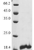 Human Neuron navigator 1 (NAV1), partial Recombinant Protein - BioCrest Sci