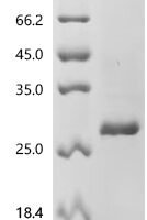 Bovine pro-epidermal growth factor (EGF), partial Recombinant Protein, N-His-TrxA - BioCrest Sci