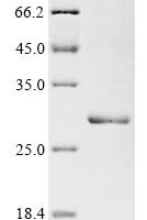 Rat Interleukin-11 (Il11) Recombinant Protein, N-His - BioCrest Sci