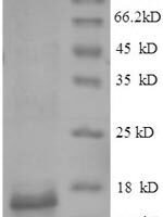 Mycobacterium tuberculosis ESAT-6-like protein EsxB (esxB) Recombinant Protein - BioCrest Sci