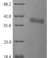 Listeria monocytogenes serotype 4b Internalin-A (inlA), partial Recombinant Protein, N-His - BioCrest Sci