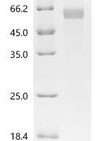 Mouse Hexokinase-2 (Hk2), partial Recombinant Protein, C-His, aa 16–458, Mammalian cell - BioCrest Sci
