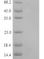 Human Transmembrane 4 L6 family member 1 (TM4SF1), partial Recombinant Protein - BioCrest Sci