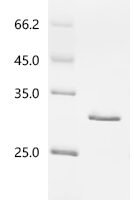 Mouse Ferritin light chain 1 (Ftl1) Recombinant Protein - BioCrest Sci