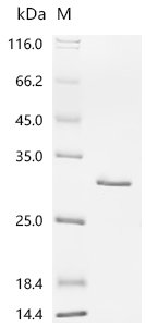 Mouse Ferritin light chain 1 (Ftl1) Recombinant Protein, Mus musculus (Mouse), E.coli, C-terminal 6xHis-tagged, 27.7 kDa, purity >≥ 95% as determined by SDS-PAGE.