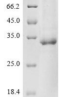 Human Protein mono-ADP-ribosyltransferase PARP9 (PARP9), partial Recombinant Protein, N-10His/C-Myc, aa 628–854, Baculovirus - BioCrest Sci