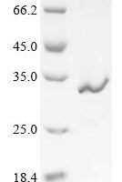 Clostridium tetani Tetanus toxin, partial Recombinant Protein, C-His, aa 1098–1310+EGWIN - BioCrest Sci