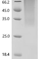 Epstein-Barr virus Glycoprotein 42 (BZLF2), partial Recombinant Protein, C-His, aa 34–223, Yeast - BioCrest Sci