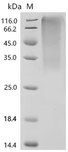 Epstein-Barr virus Glycoprotein 42 (BZLF2), partial Recombinant Protein, C-His, aa 34–223, Yeast, Epstein-Barr virus (strain B95-8) (HHV-4) (Human herpesvirus 4), Yeast, C-terminal 6xHis-tagged, 23.1 kDa, purity >≥ 95% as determined by SDS-PAGE.