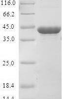 Human Cyclin-dependent kinase 4 inhibitor D (CDKN2D) Recombinant Protein - BioCrest Sci
