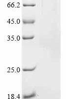 Human Maltase-glucoamylase (MGAM), partial Recombinant Protein - BioCrest Sci