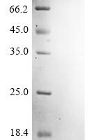 Chicken Lysozyme C (LYZ) (E53A) Recombinant Protein - BioCrest Sci