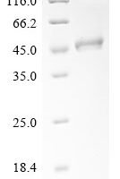 Saccharomyces cerevisiae Phosphatidylinositol N-acetylglucosaminyltransferase GPI3 subunit (SPT14), partial Recombinant Protein, N-10His/C-Myc - BioCrest Sci
