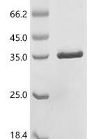Human Netrin receptor UNC5C (A150V), partial Recombinant Protein - BioCrest Sci