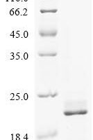Human Estrogen receptor (ESR1), partial Recombinant Protein - BioCrest Sci