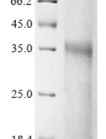 Human Fibronectin type III domain-containing protein 3B (FNDC3B), partial Recombinant Protein - BioCrest Sci