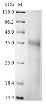 Human Fibronectin type III domain-containing protein 3B (FNDC3B), partial Recombinant Protein, Homo sapiens (Human), Yeast, C-terminal 6xHis-tagged, 34.1 kDa, purity >≥ 90% as determined by SDS-PAGE.