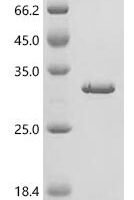 Human GTPase KRas (KRAS) Recombinant Protein, C-His - BioCrest Sci