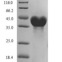 Colwellia psychrerythraea DNA ligase (ligA), partial Recombinant Protein - BioCrest Sci