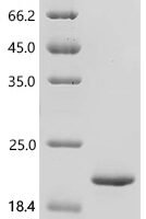 Mycobacterium tuberculosis Co-chaperonin GroES (groES) Recombinant Protein, C-His, aa 1–100, E.coli - BioCrest Sci