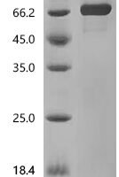 Cat Albumin (ALB) Recombinant Protein, C-His, aa 25–608, Yeast - BioCrest Sci