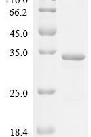 Human Troponin I, slow skeletal muscle (TNNI1) Recombinant Protein - BioCrest Sci
