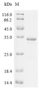 Human Troponin I, slow skeletal muscle (TNNI1) Recombinant Protein, Homo sapiens (Human), E.coli, C-terminal 6xHis-tagged, 28.5 kDa, purity >≥ 85% as determined by SDS-PAGE.