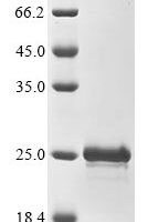Mouse Thymosin beta-10 (Tmsb10) Recombinant Protein - BioCrest Sci