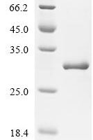 Vespula vulgaris Venom allergen 5 Recombinant Protein - BioCrest Sci
