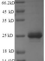 Rabies virus Matrix protein (M) Recombinant Protein, N-His - BioCrest Sci