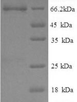 Pig Electron transfer flavoprotein-ubiquinone oxidoreductase, mitochondrial (ETFDH) Recombinant Protein - BioCrest Sci