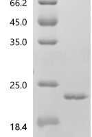 Human Bile acid receptor (NR1H4), partial Recombinant Protein - BioCrest Sci