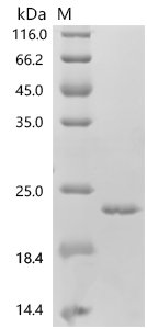 Human Bile acid receptor (NR1H4), partial Recombinant Protein, E.coli, C-terminal 6xHis-tagged, 20.6 kDa, purity >≥ 90% as determined by SDS-PAGE.