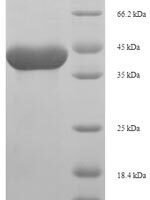 Rat Serine protease 1 (Prss1) Recombinant Protein - BioCrest Sci