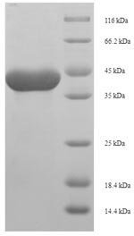 Rat Serine protease 1 (Prss1) Recombinant Protein, Rattus norvegicus (Rat), E.coli, N-terminal 6xHis-SUMO-tagged, 39.6 kDa, purity >≥ 90% as determined by SDS-PAGE.