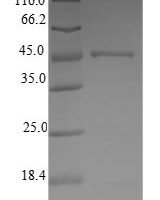 Human ATP synthase subunitd, mitochondrial (ATP5H) Recombinant Protein - BioCrest Sci